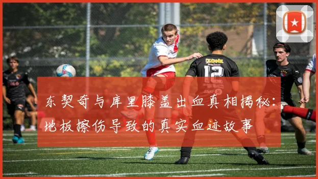 东契奇与库里膝盖出血真相揭秘：地板擦伤导致的真实血迹故事
